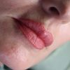 Lip Blushing - Image 5